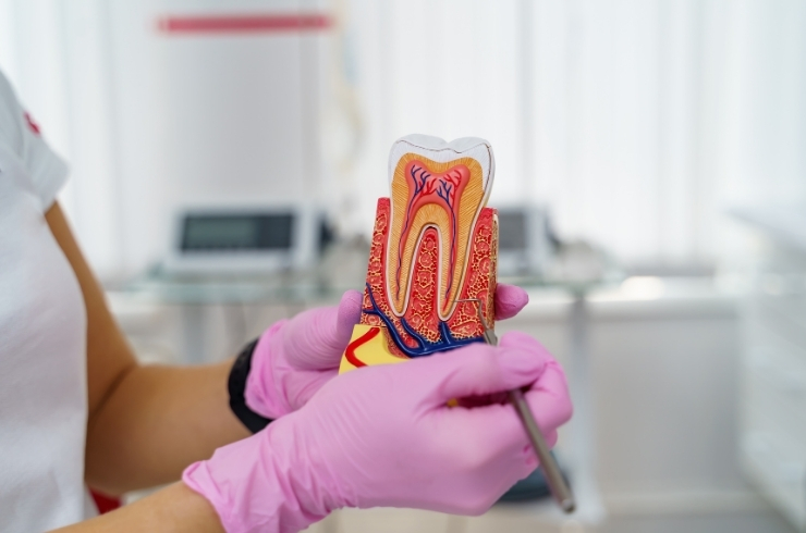Root Canal Treatment